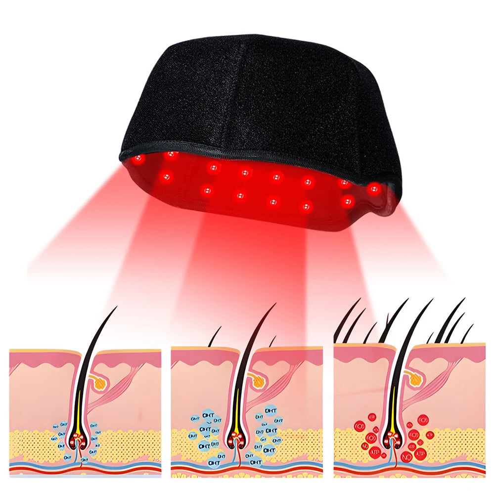 300Pcs Beams hair growth cap 650nm 850nm Red light Near Infrared Therapy Hat Anti Hair Loss Relax scalp Massager Rechargeable